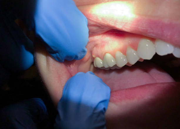 Best Cracked Tooth Emergency Dentist  in Staunton, IL