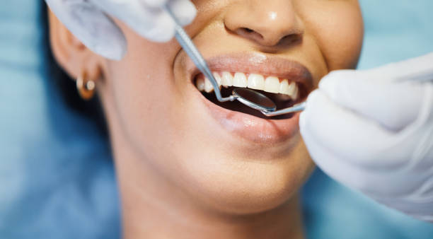 Best Chipped Tooth Repair Near Me  in Staunton, IL