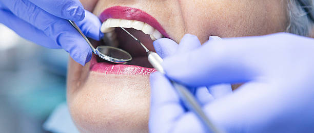 Best Teeth Whitening  in Staunton, IL